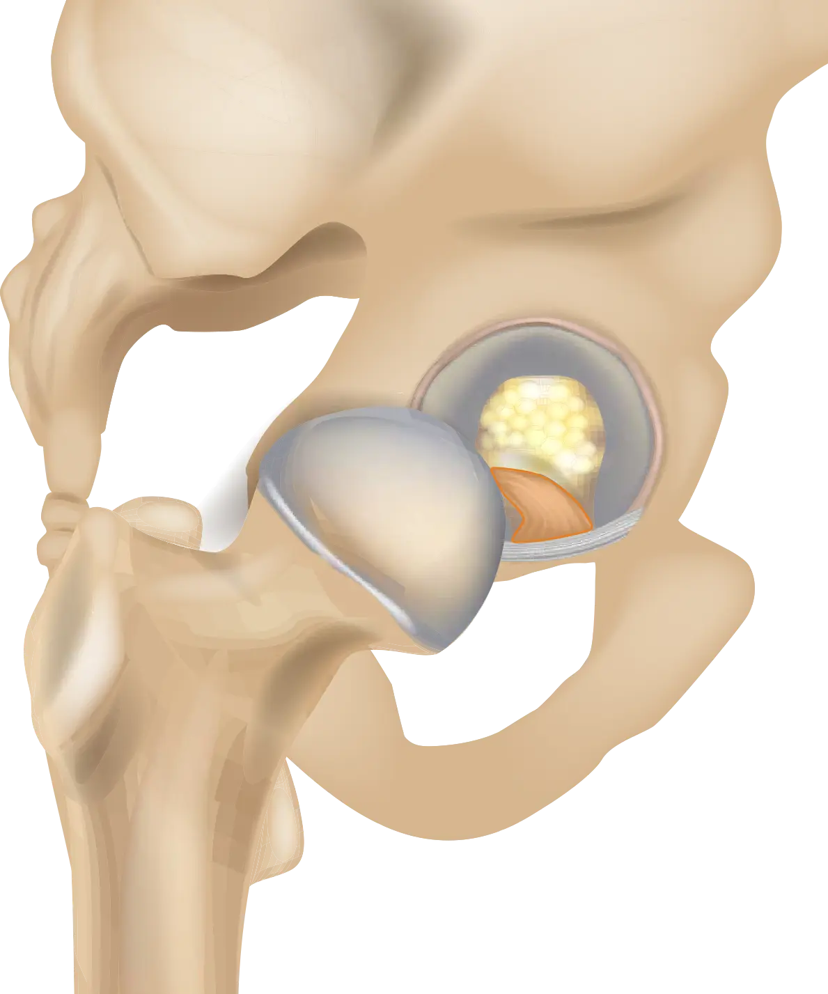 Ligamentum capitis femoris