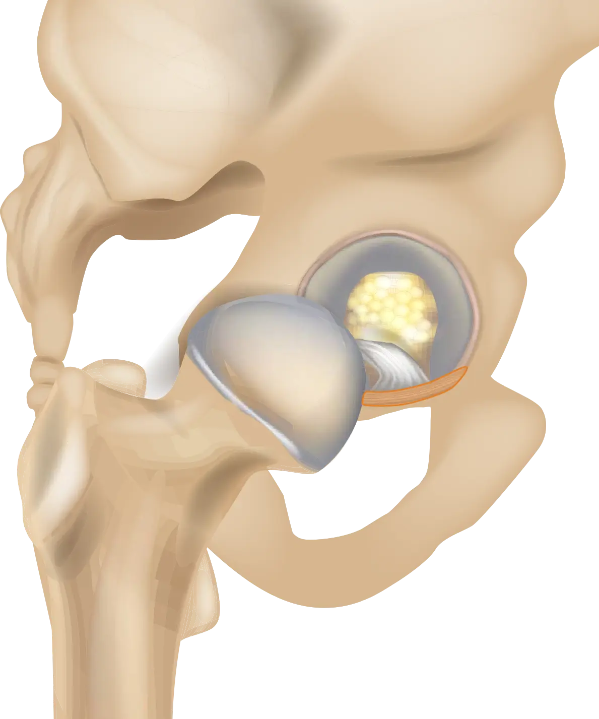 Ligamentum transversum acetabuli